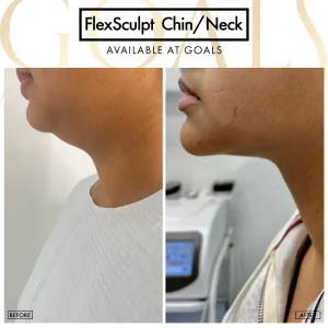 Before and after, patient 4