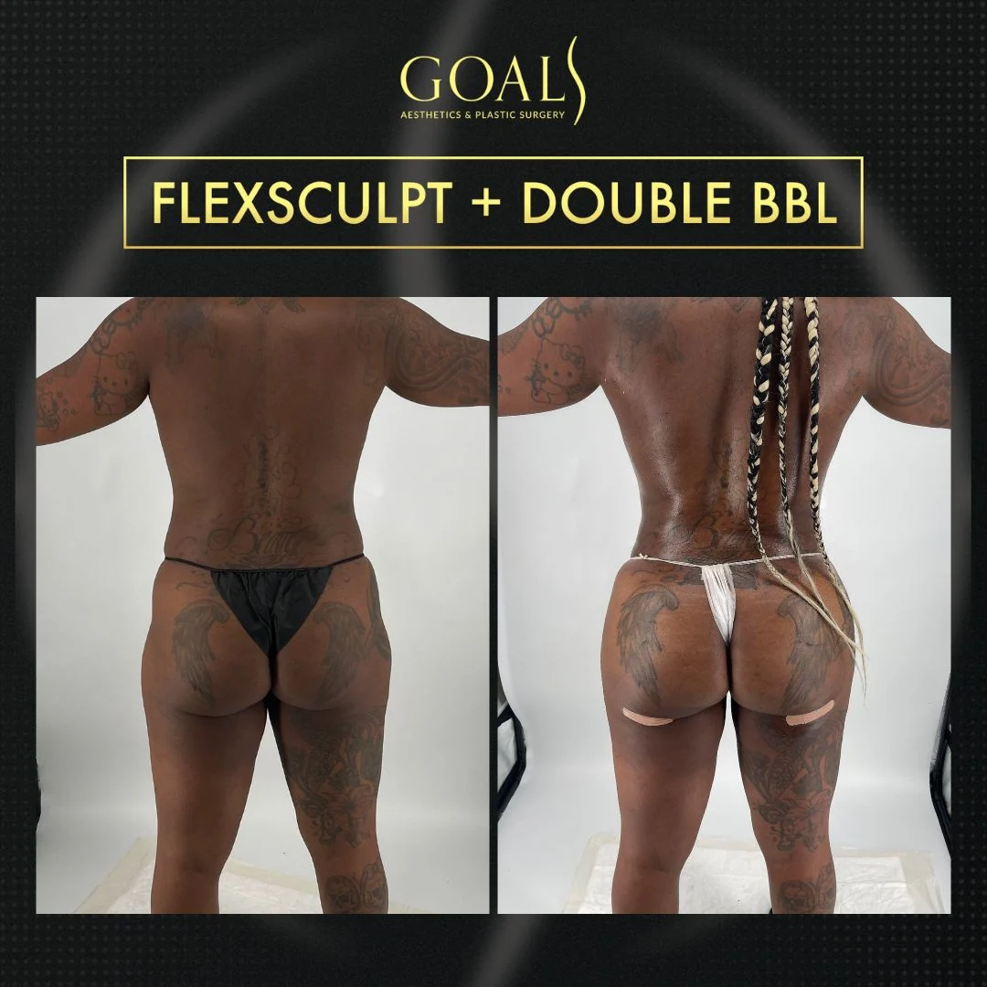 Before and after — Ridgefield, patient 2