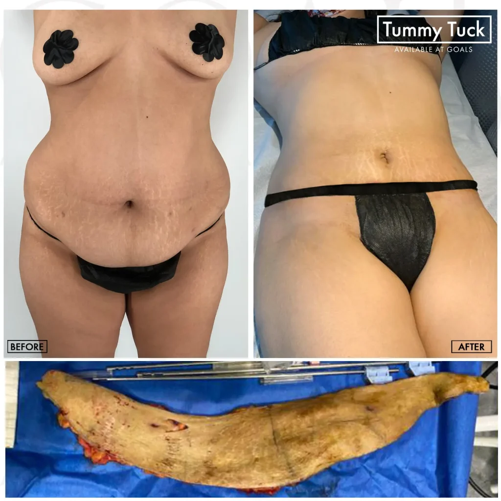 Before and after, patient 5