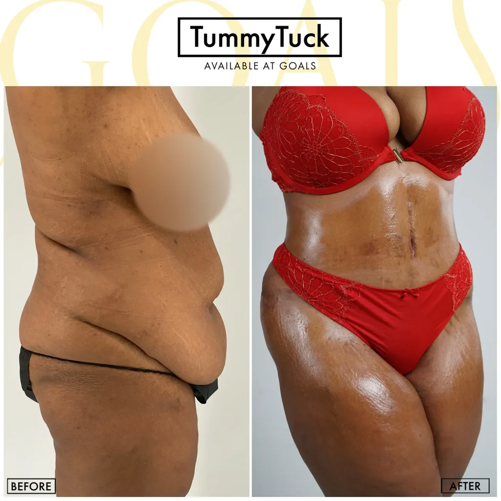 Before and after — Gaithersburg, patient 5