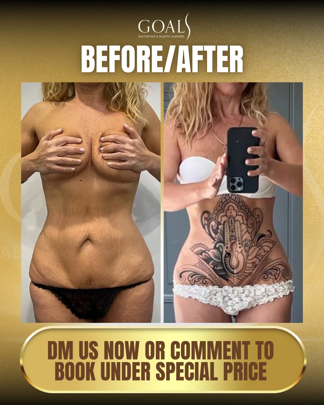 Before and after — Brooklyn, patient 6