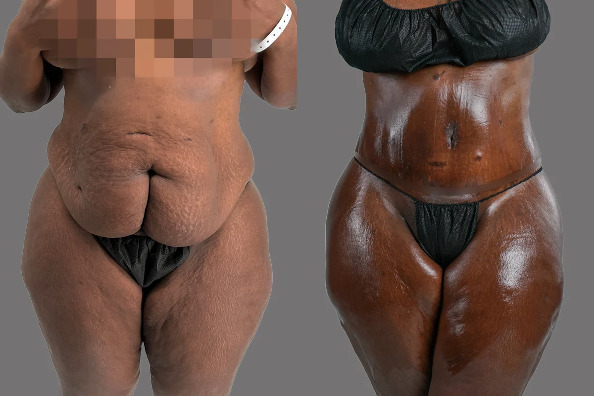 Before and after, patient 6